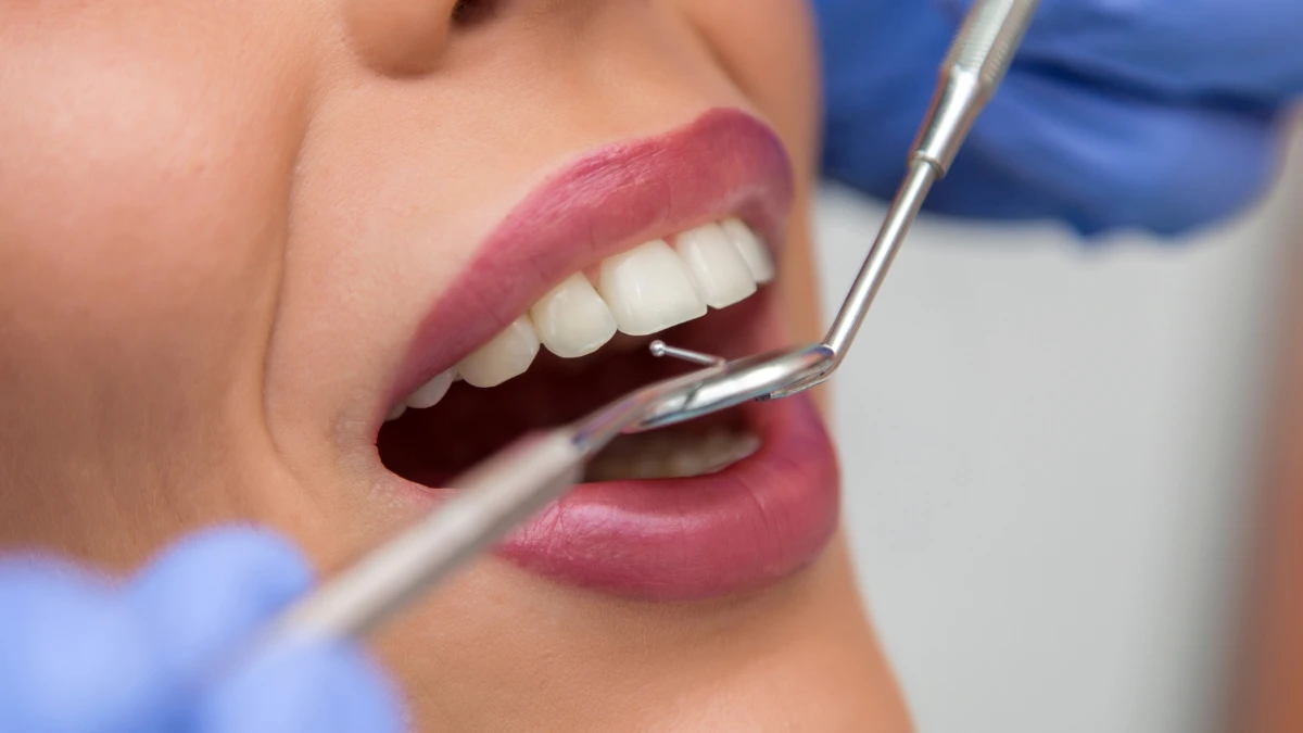 Dental Bonding Wasilla AK Dental Bonding Wasilla AK