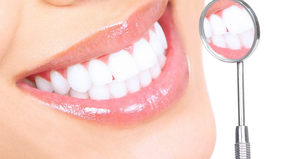 Teeth Whitening at Dentist hackensack Teeth Whitening at Dentist Wasilla